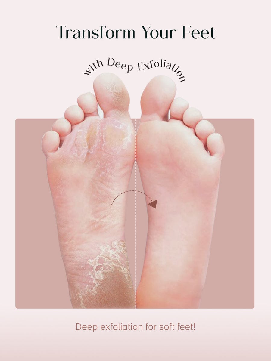 Exfoliating Foot Peel & Whitening Mask (One pair)