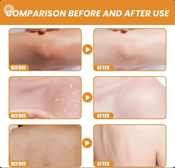 Orange Zyme Deep Clean Gel – Soft & Bright Skin Solution